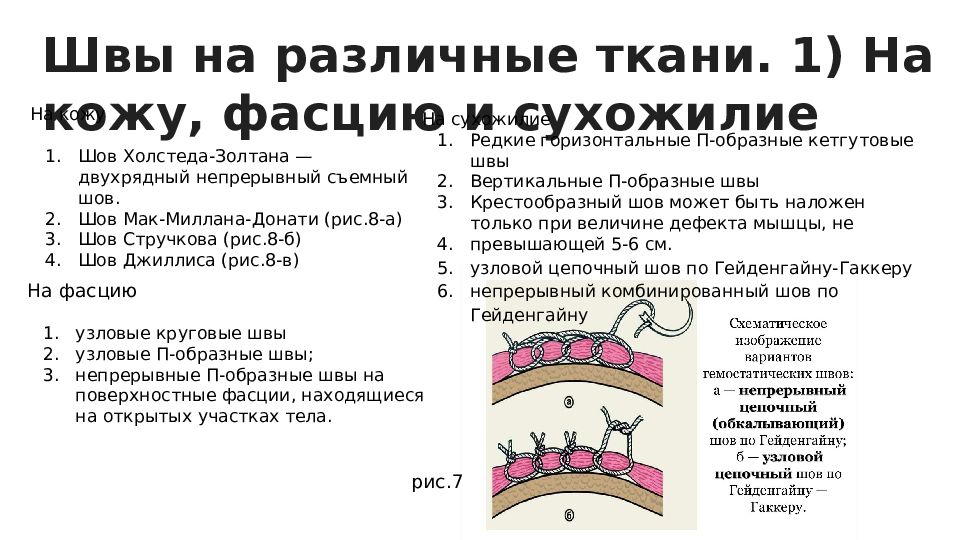 8 швов