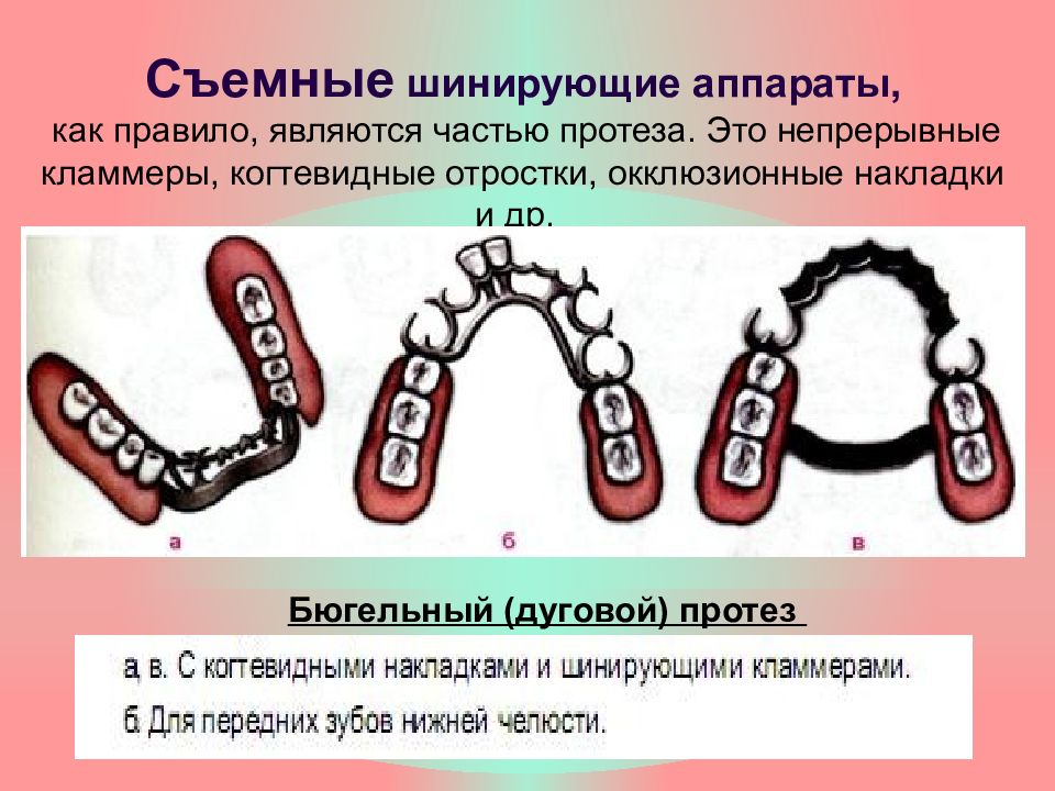 Наложение сложных шин и шин протезов реабилитация больных пародонтитом презентация