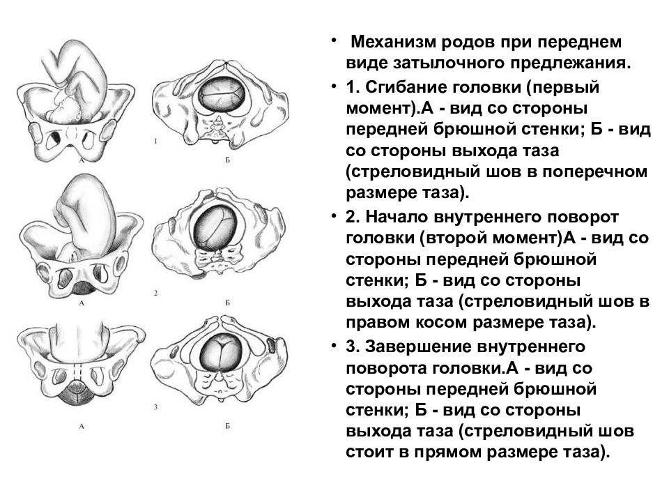 Виды затылочного предлежания. Механизм родов Акушерство. Первый момент механизма родов при переднем виде затылочного. Механизм родов при переднем затылочном предлежании. Задний вид затылочного предлежания стреловидный шов.