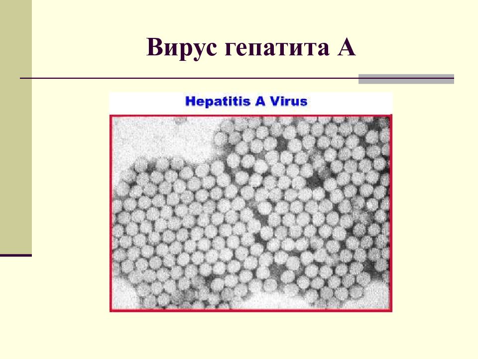 Острые вирусные гепатиты в ультразвуковом изображении сопровождаются