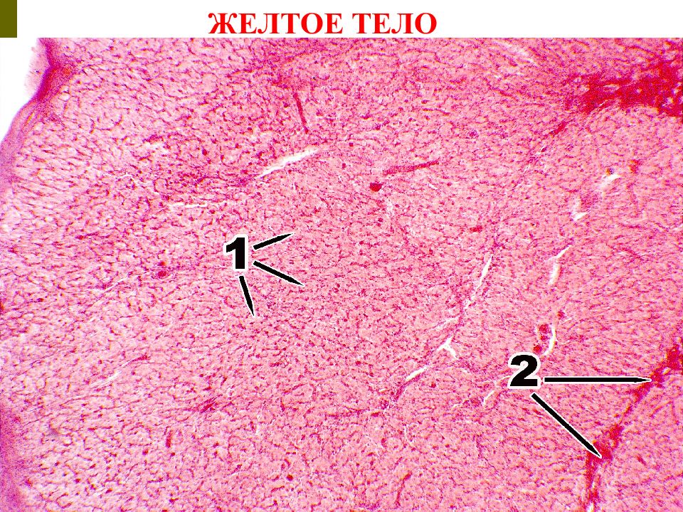 Желтое тело гистология рисунок