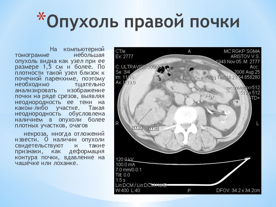 Лучевая диагностика почек презентация