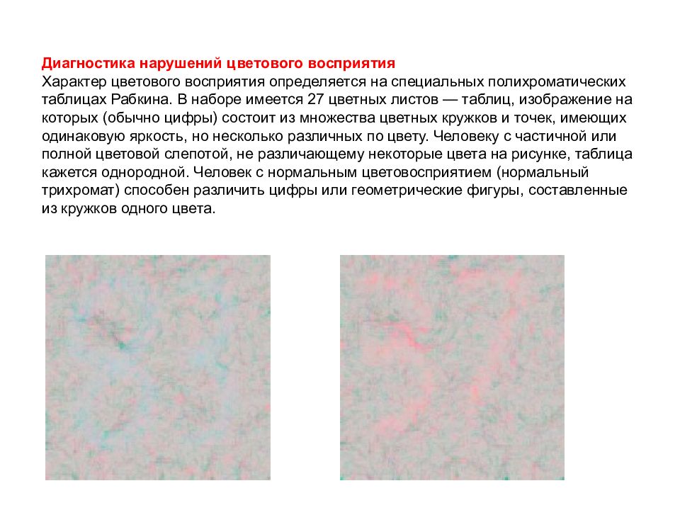 Нарушение цветного зрения. Нарушение цветового зрения. Основные формы нарушения цветового зрения. Диагностика восприятия цвета. Диагностика нарушенного цветного зрения.