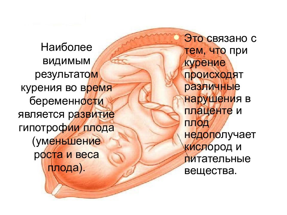 Влияние курения на развитие плода презентация