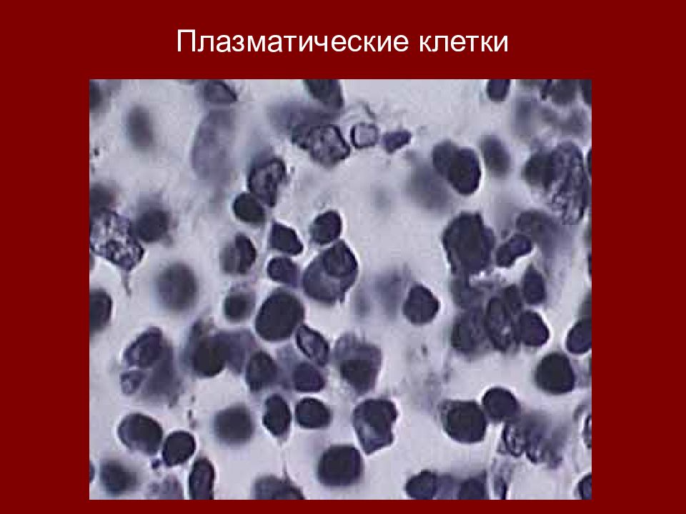 1 плазматическая клетка. Плазматические клетки плазмоциты. Плазматические клетки в крови. Плазматические клетки под микроскопом. Плазмоциты фото.