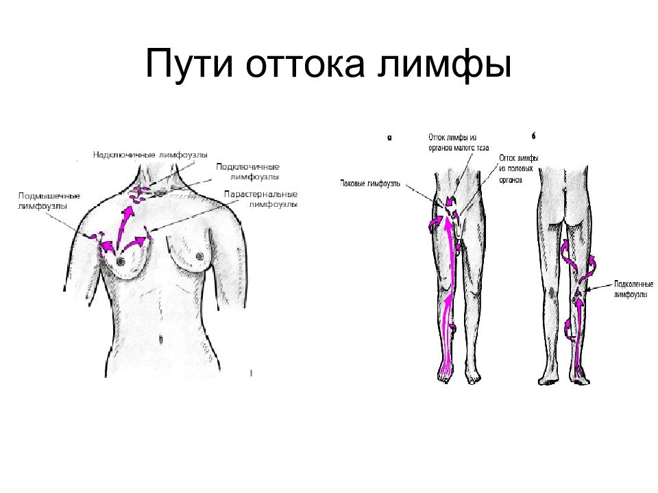 Лимфоузлы у женщин расположение схема рисунок