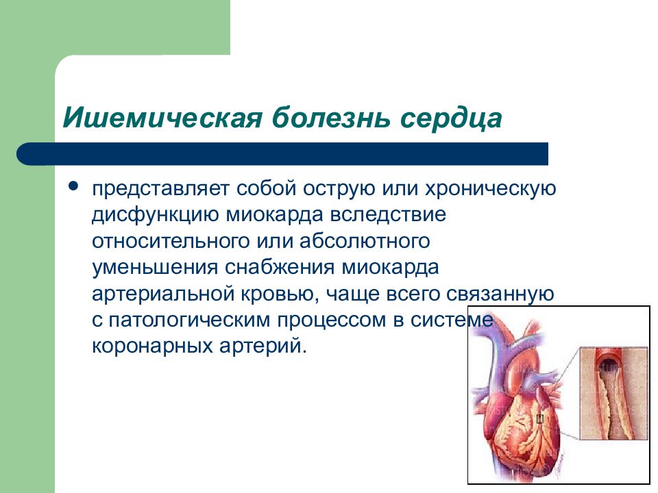 Области ишемии. Острая ишемическая болезнь сердца. Острые заболевания сердца. Ишемическая болезнь сердца презентация.