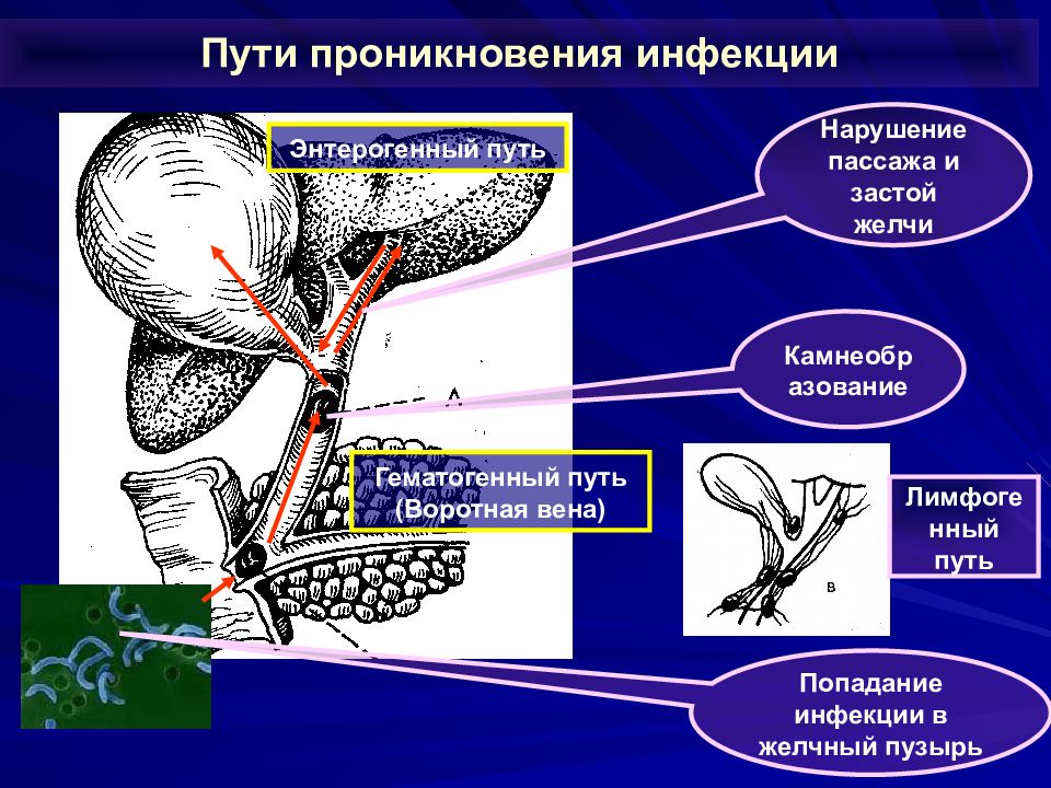 Жкб механическая желтуха карта вызова