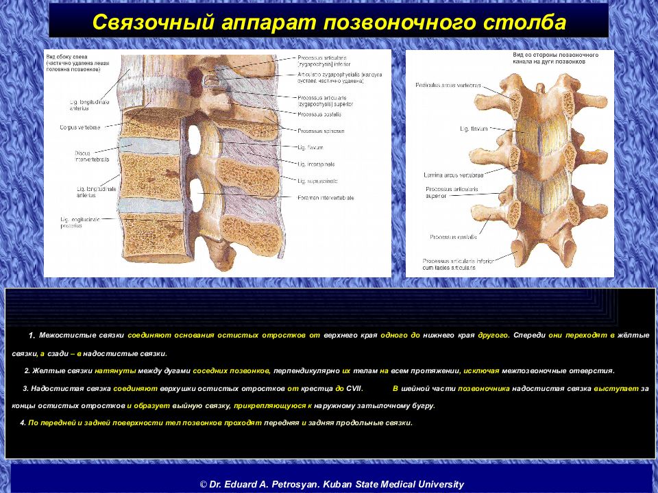 Связки позвоночника. Связочный аппарат позвонков. Связочный аппарат позвоночника и межпозвонковые диски. Связки позвоночного столба вид спереди. Межостистая связка.