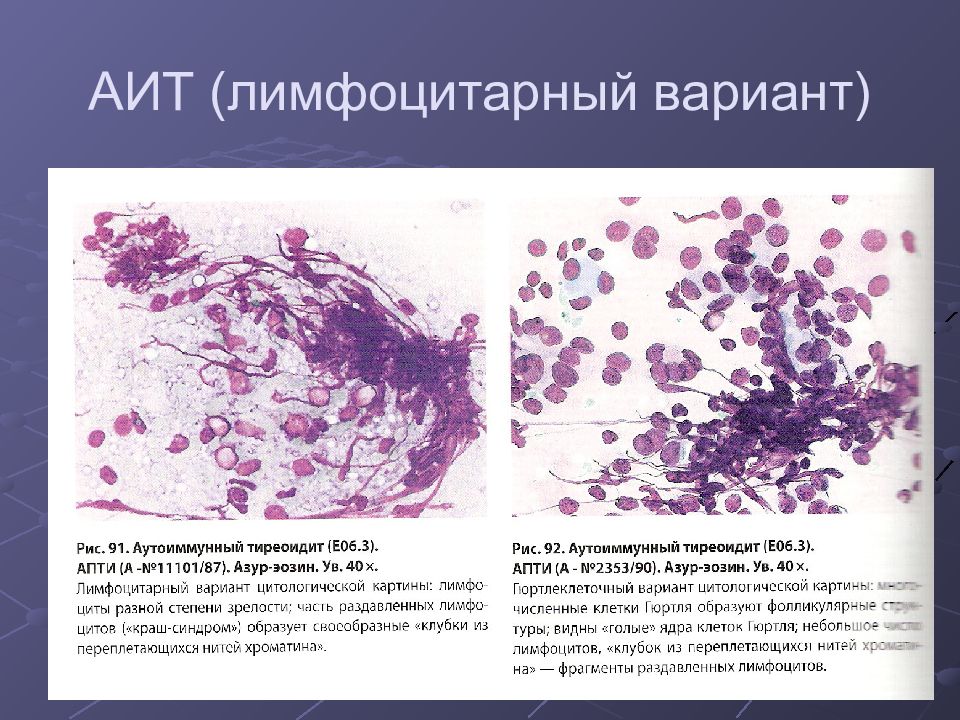 Цитологическая диагностика заболеваний молочной железы презентация