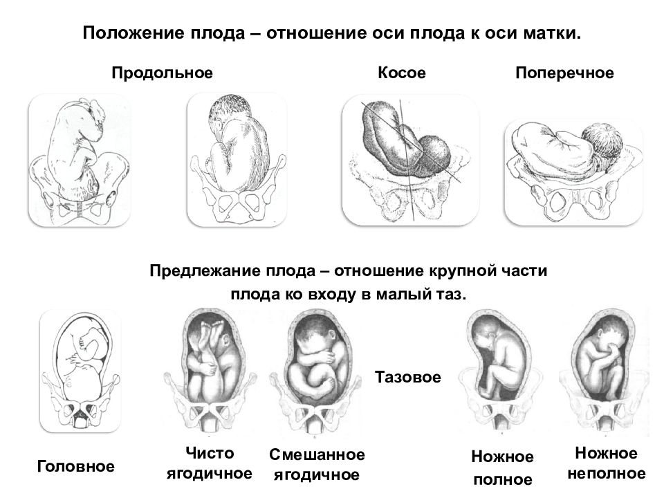 Положение плода картинки