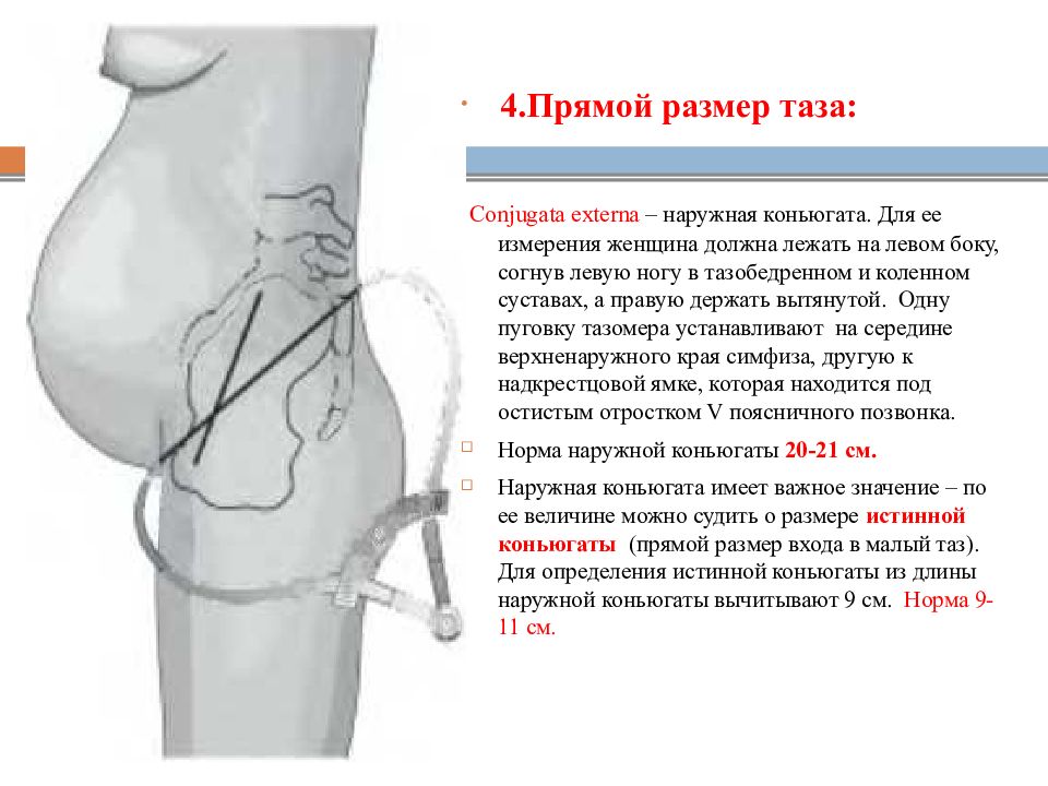 Презентация методы исследования в акушерстве