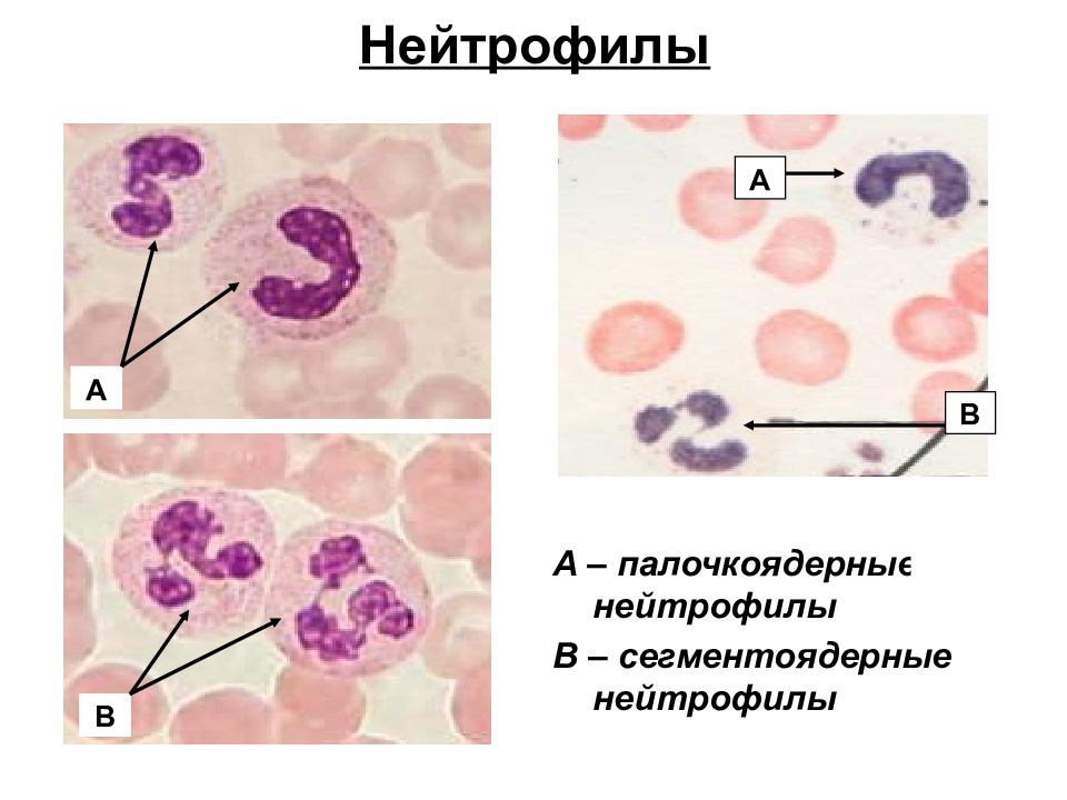 Палочкоядерные нейтрофилы картинки