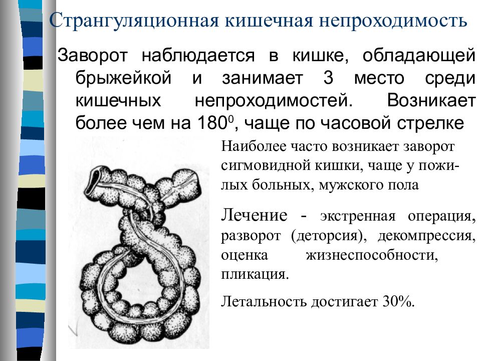 Заворот кишок симптомы у детей