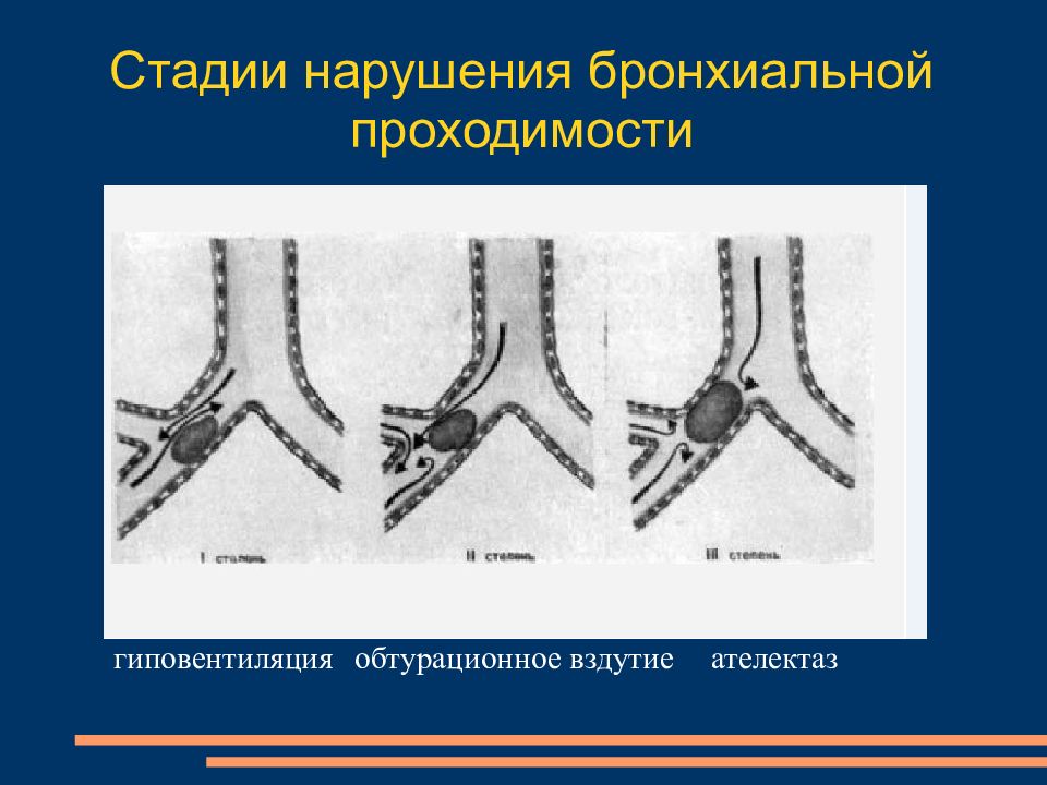 Рентгеновская картина нарушений бронхиальной проходимости