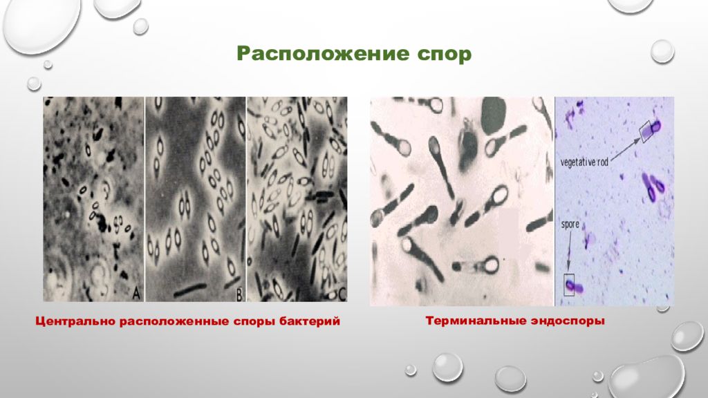 Чем отличается спора гриба от споры бактерии. Терминальное расположение спор у бактерий. Расположение спор у бактерий. Споры бактерий расположение.