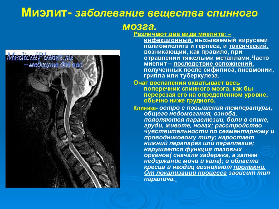 Спинной мозг неврология презентация