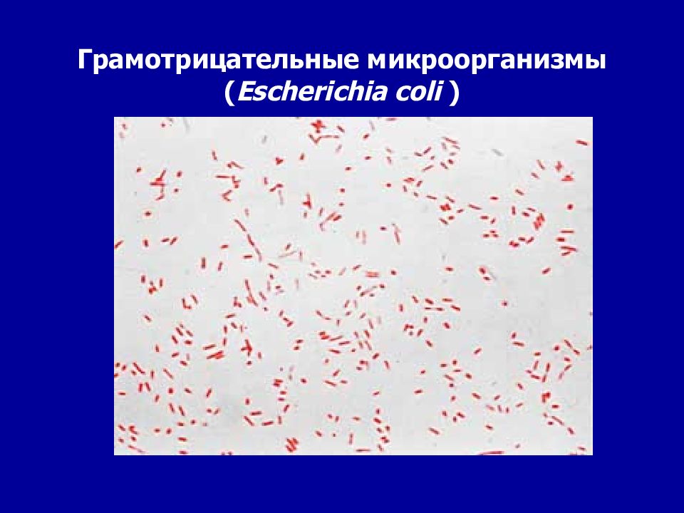 Грамотрицательные палочки возбудители. Грамотрицательная бактерия. Грамположительные микроорганизмы. Грамположительные и грамотрицательные бактерии.