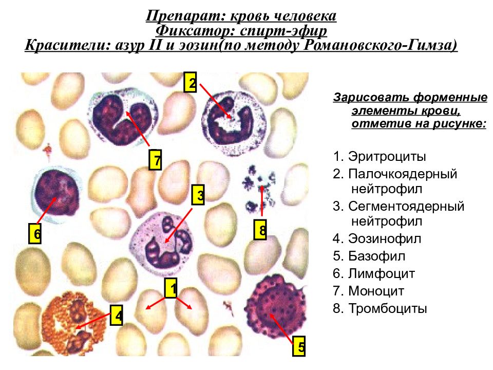 Препарат человека. Препарат мазок крови человека окраска Азур 2-эозином. Мазок крови гистология препарат. Мазок крови человека гистология препарат. Кровь человека Азур-эозин по Романовскому.