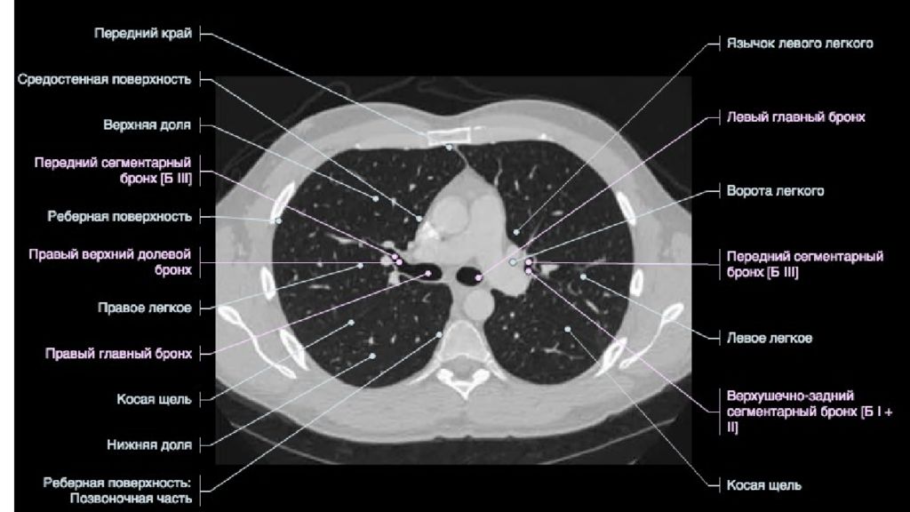 Что является основой изображения органов на кт