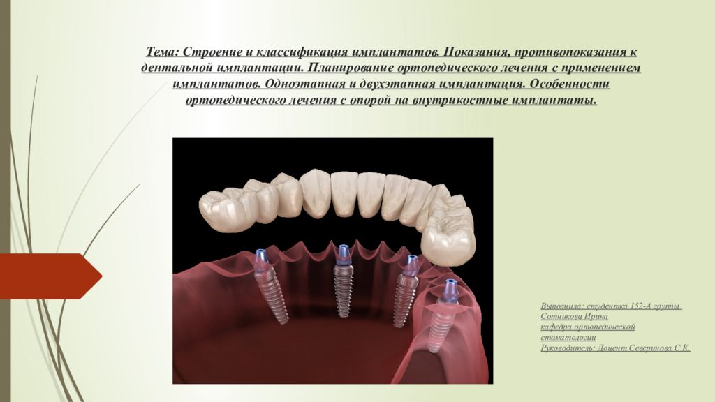 Анатомические предпосылки стоматологической имплантации презентация