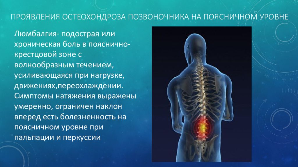 Симптомы остеохондроза позвоночника. Проявление остеохондроза позвоночника. Клинические проявления остеохондроза. Презентация на тему остеохондроз. Клинические симптомы остеохондроза.