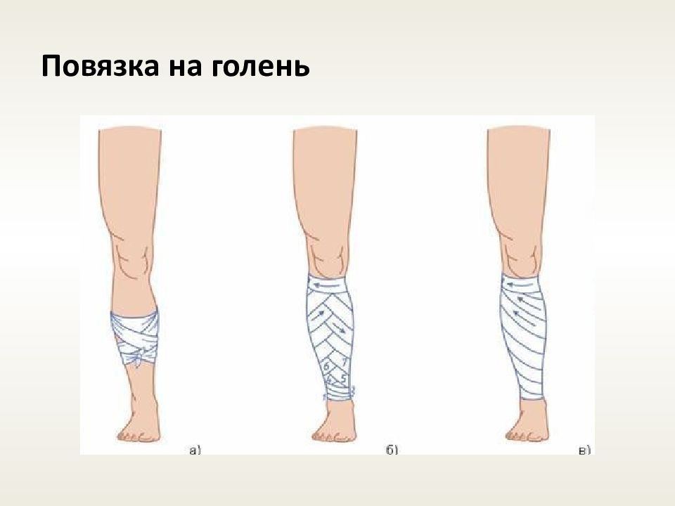 Горин почему повязка на ноге 7 класс презентация