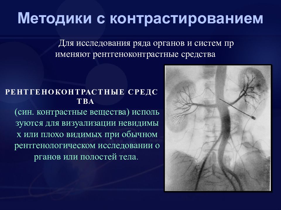 Рентгеноскопия контрастное вещество. Контрастные методы рентген. Рентгенонегативные контрастные вещества. Контрастные методы исследования в рентгенологии. Классификация контрастных средств в рентгенологии.