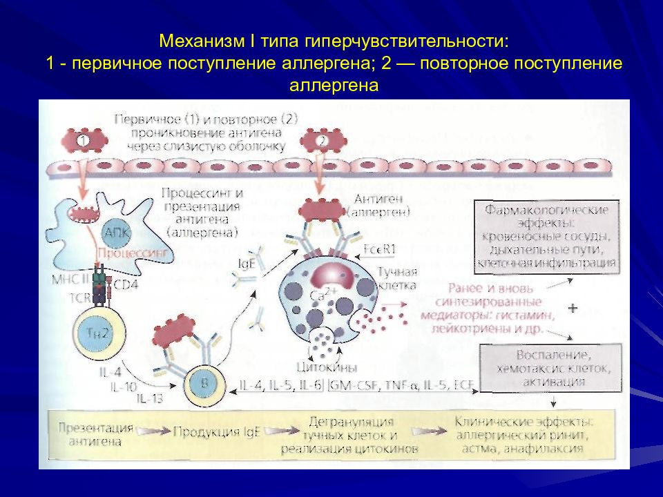 Гиперчувствительность 1 типа схема