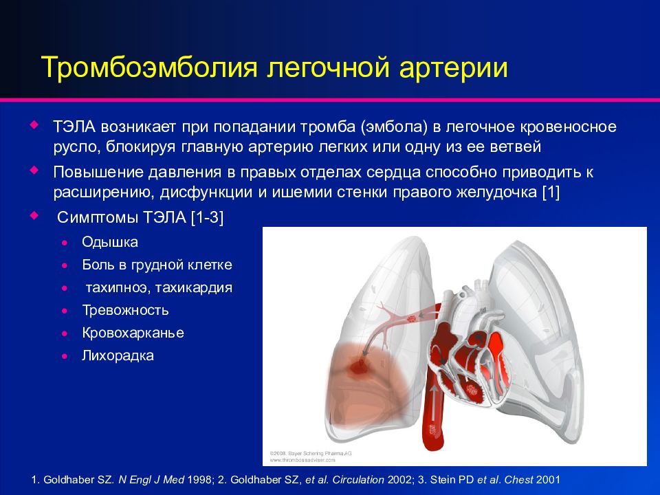 Тэла презентация терапия