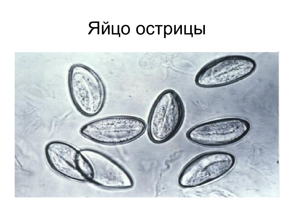 Яйца остриц. Яйца остриц под микроскопом. Яйцо острицы строение. Enterobius vermicularis яйца под микроскопом.