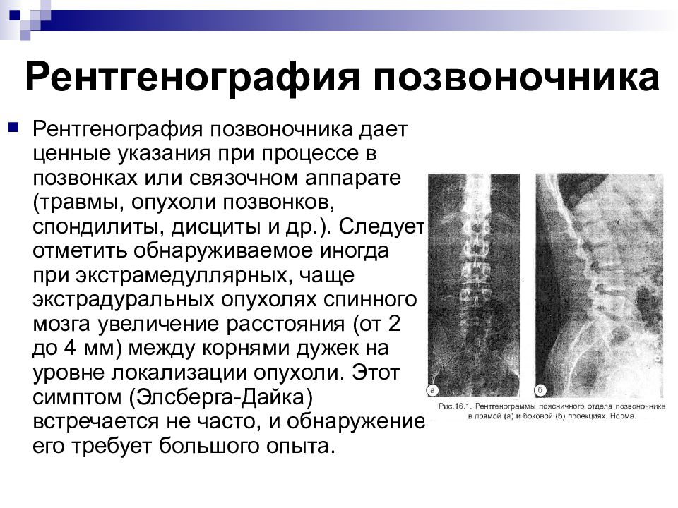 Рентген грудного отдела что показывает