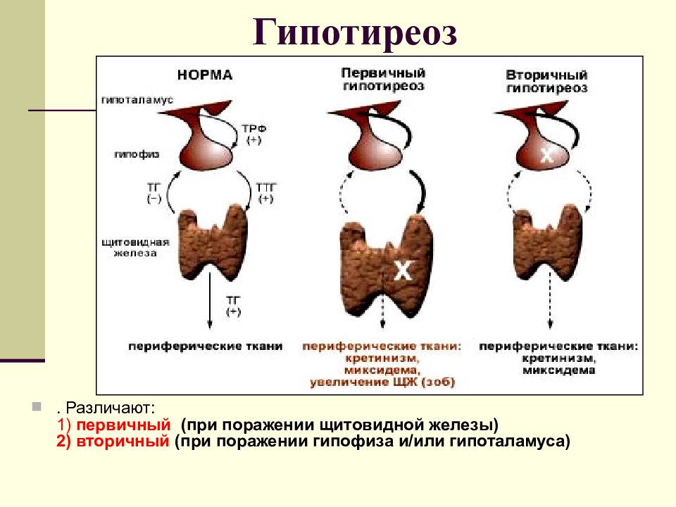 3 гипотиреоз. Гипофункция гормонов щитовидной железы. Первичная гипофункция щитовидной железы. Тиреоидные гормоны гипотиреозе. Снижение функции щитовидной железы (гипотиреоз).