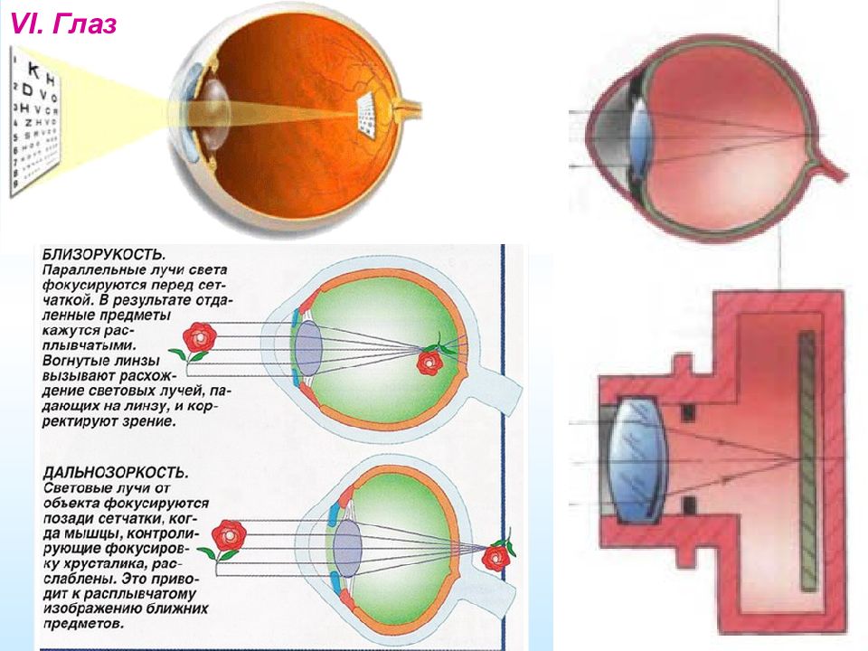 Изображения предметов фокусируются. Ход лучей в глазу при миопии. Близорукость лучи фокусируются. При близорукости лучи света фокусируются. При миопии лучи фокусируются.