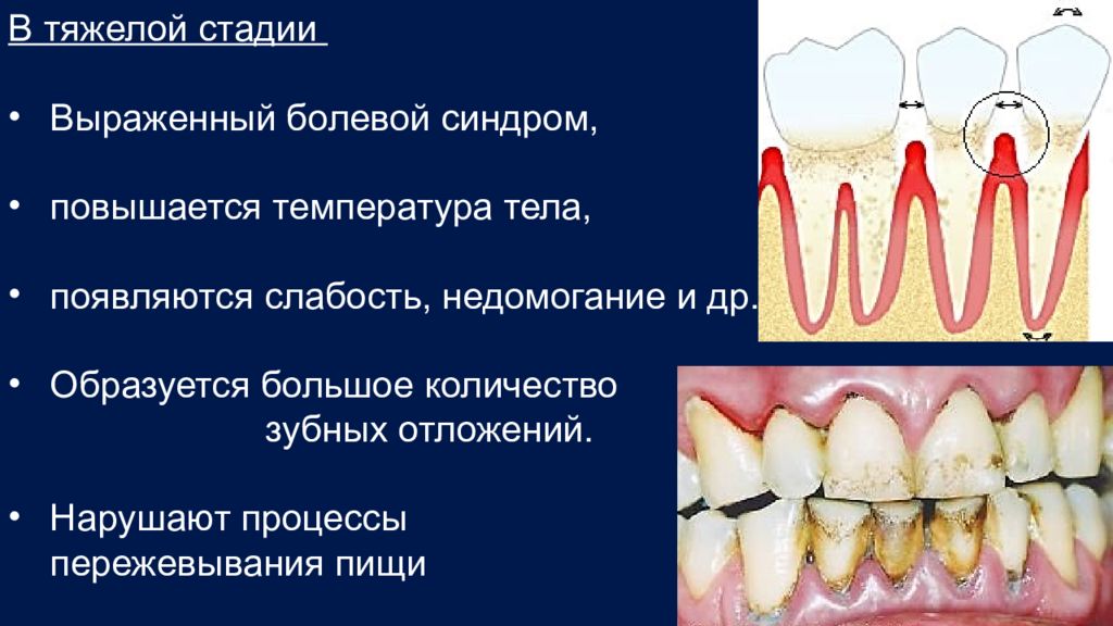 Твердые ткани зуба. Биология пульпы зуба, связь пульпы и твердых тканей зуба. Заболевания твердых тканей зуба. Сестринский процесс при заболеваниях твердых тканей зуба. Температурная и болевая чувствительность периодонта.