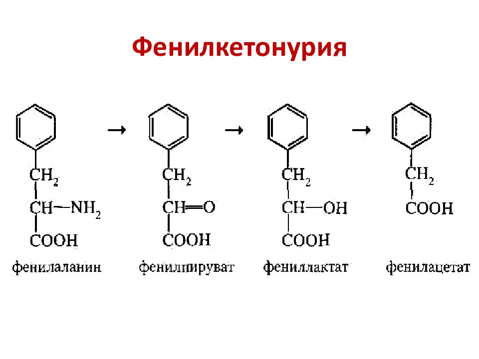 Фенилкетонурия биохимия. Фенилкетонурия реакция. Фенилкетонурия фенилаланин. Фенилаланина при фенилкетонурии. Превращение фенилаланина при фенилкетонурии.