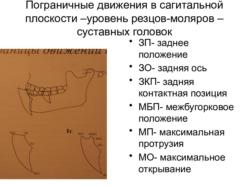 Максимальное положение. Задняя контактная позиция нижней челюсти это. Заднее положение нижней челюсти. Артикуляция нижней челюсти. Центральная контактная позиция.