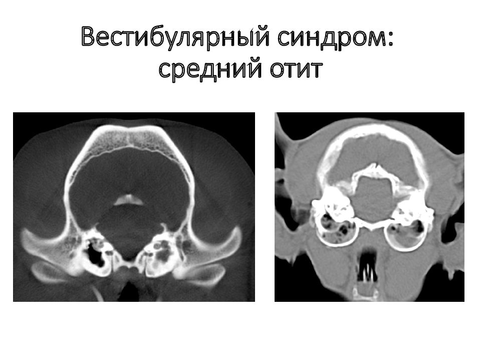 Средний отит кт картина