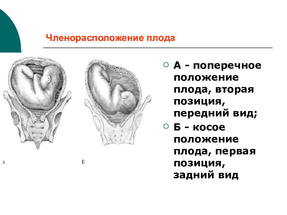 Поперечное положение