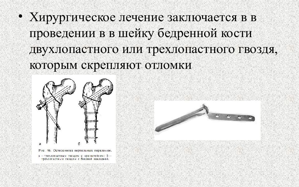 Презентация на тему переломы нижних конечностей