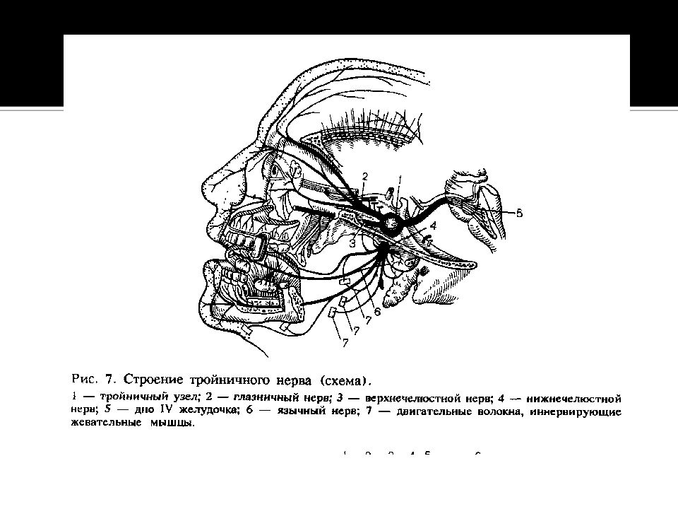 Тройничного нерва 9 букв. 2 Ветвь тройничного нерва схема. Тройничный нерв анатомия ветви схема. 3 Ветвь тройничного нерва схема. Двигательные волокна тройничного нерва.