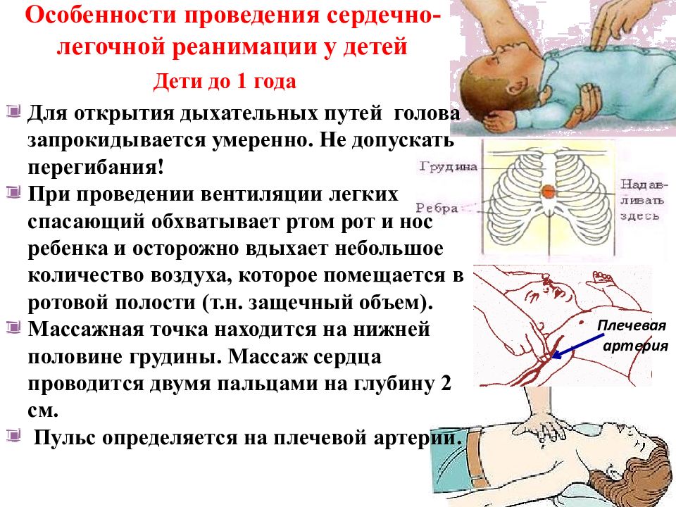 Презентация массаж сердца