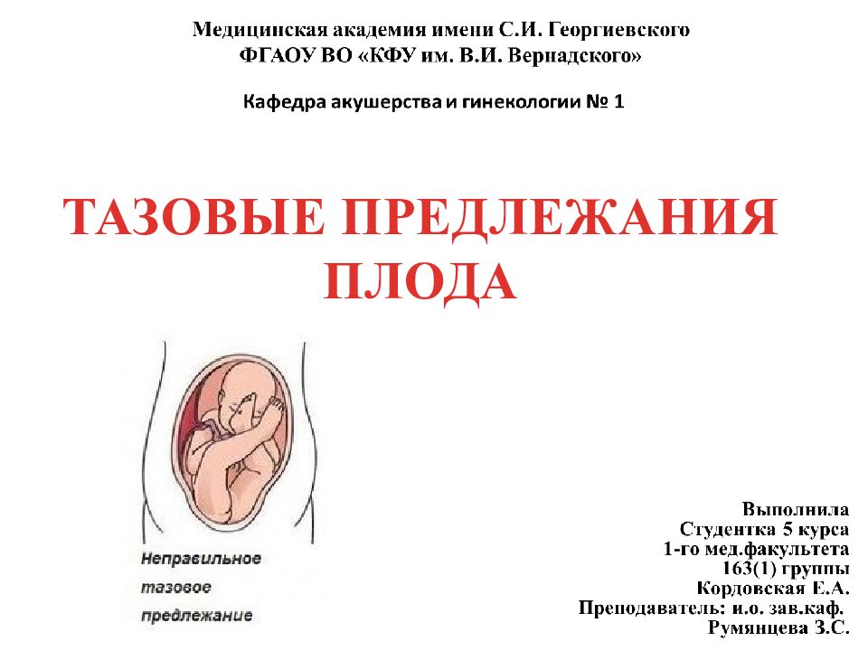 Тазовые предлежания плода презентация