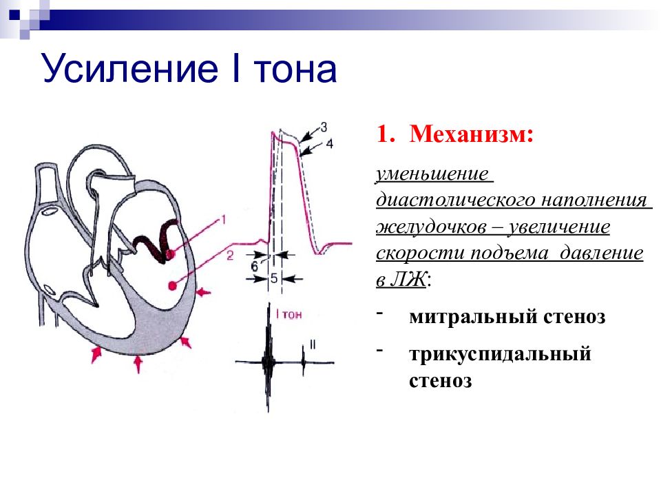 Схема тоны сердца