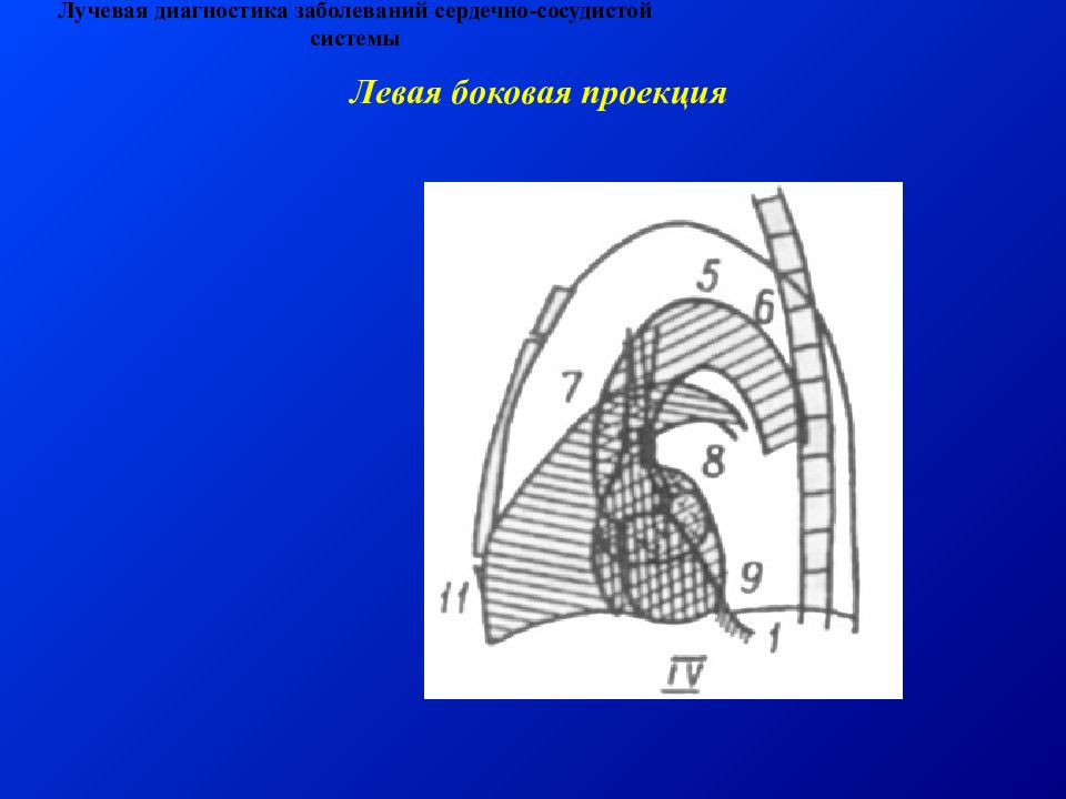 Латеральная проекция. Проекции в лучевой диагностике. Дом за 10 дней боковая проекция.