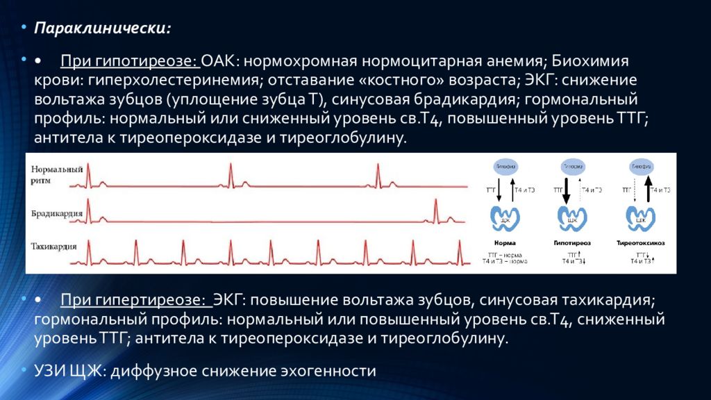 Экг при тиреотоксикозе картинки