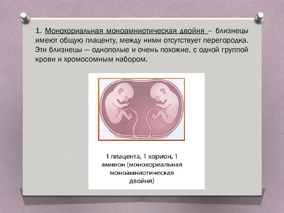 Признаки двойни на ранних сроках беременности. Монохориальная моноамниотическая двойня 7 недель. Моноамниотическая двойня УЗИ. Монохориальная моноамниотическая двойня УЗИ. Тест на беременность при многоплодной беременности.