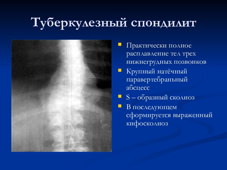 Лучевая диагностика позвоночник презентация