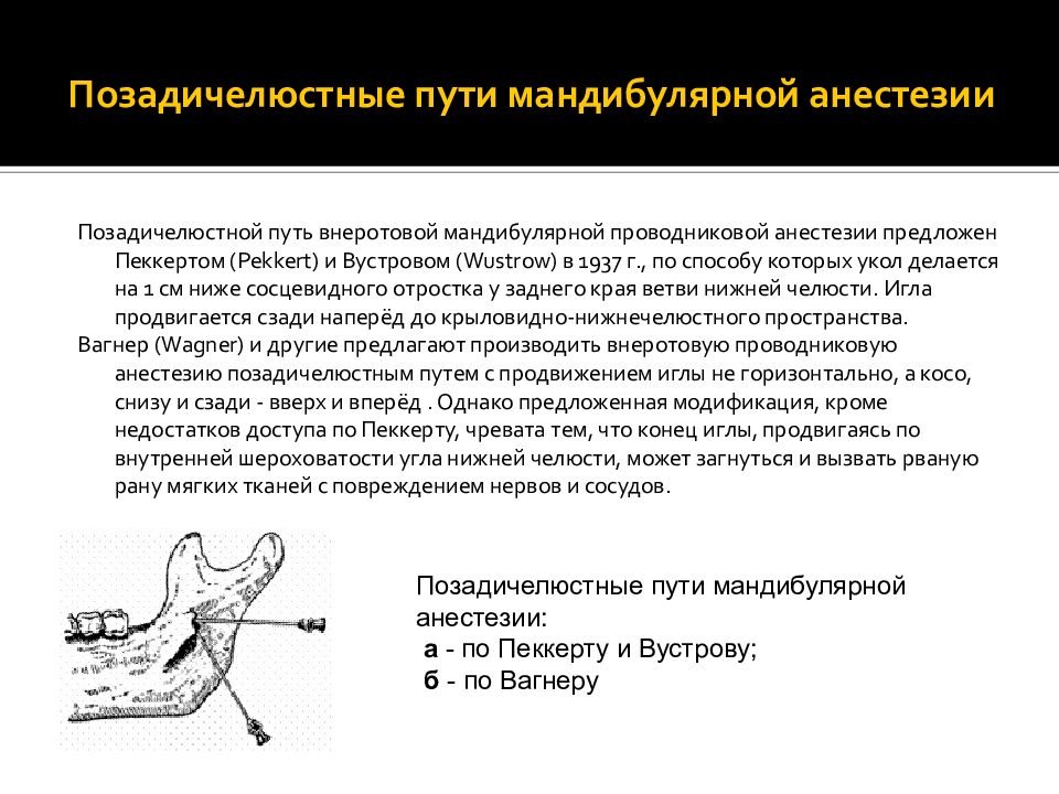 Проведение проводниковой анестезии. Проводниковая анестезия нижней челюсти мандибулярная. Торусальная анестезия нижней челюсти. Мандибулярная анестезия по Лагарди. Мандибулярная анестезия нижней челюсти.