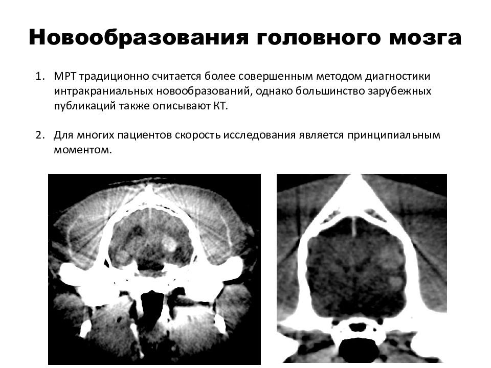 Компьютерная томография в неврологии презентация